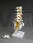 Vertebral Column, Lumbar w Herniated Disc